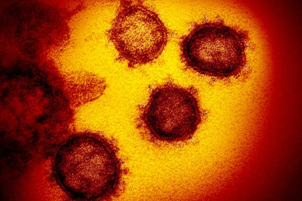 coronavirus foto a colori virus cinese