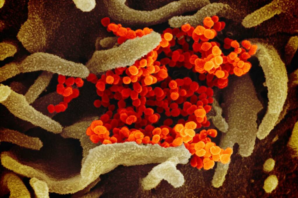 coronavirus foto a colori virus cinese
